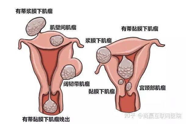 （注