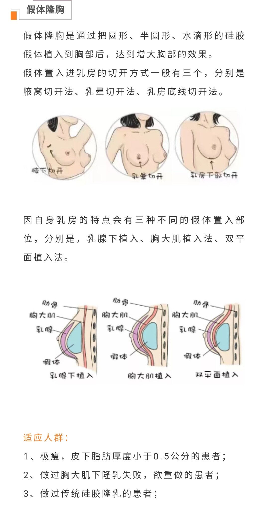 最新隆胸方法揭秘，打造完美曲线，你还在等什么？